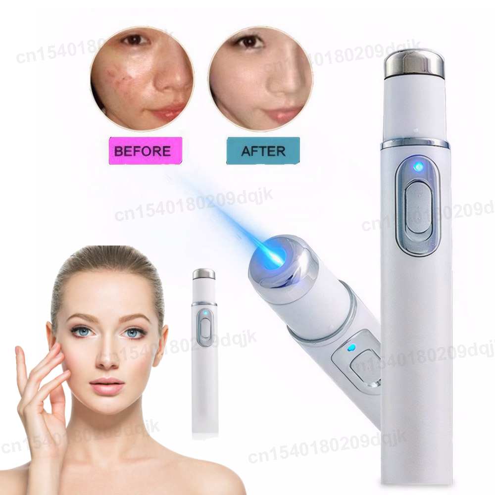 Terapi Cahaya Biru Pena Jerawa - Acne Light Therapy Pen ulasan dan harga